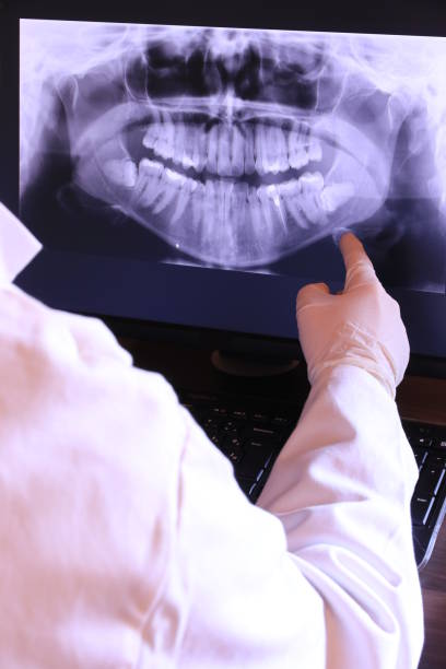 Best Emergency Root Canal Treatment in Mineral Point, WI