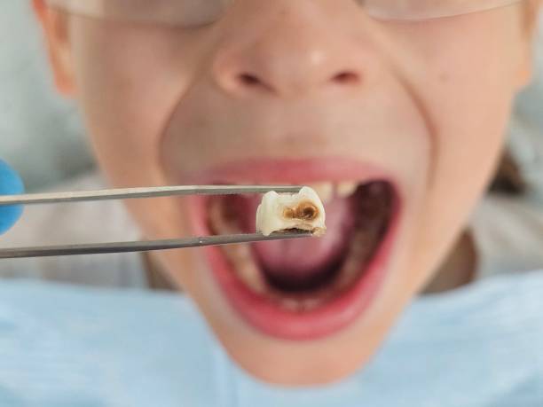 Best Emergency Dental Services for Seniors in Mineral Point, WI